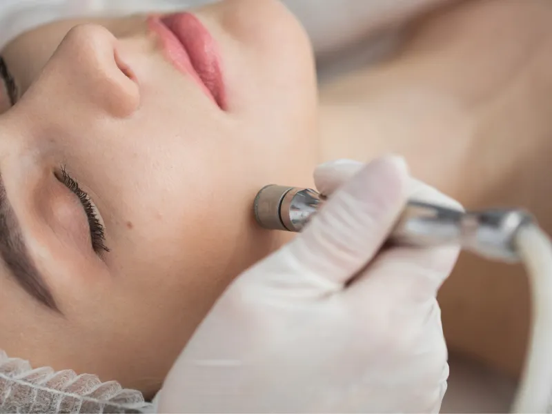 Peeling de Diamante